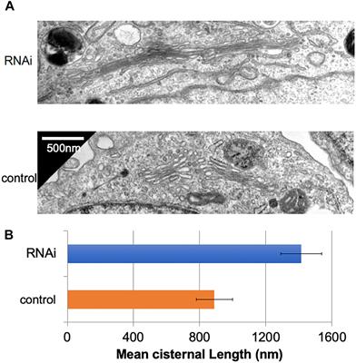 The Golgin Protein Giantin Regulates Interconnections Between Golgi Stacks